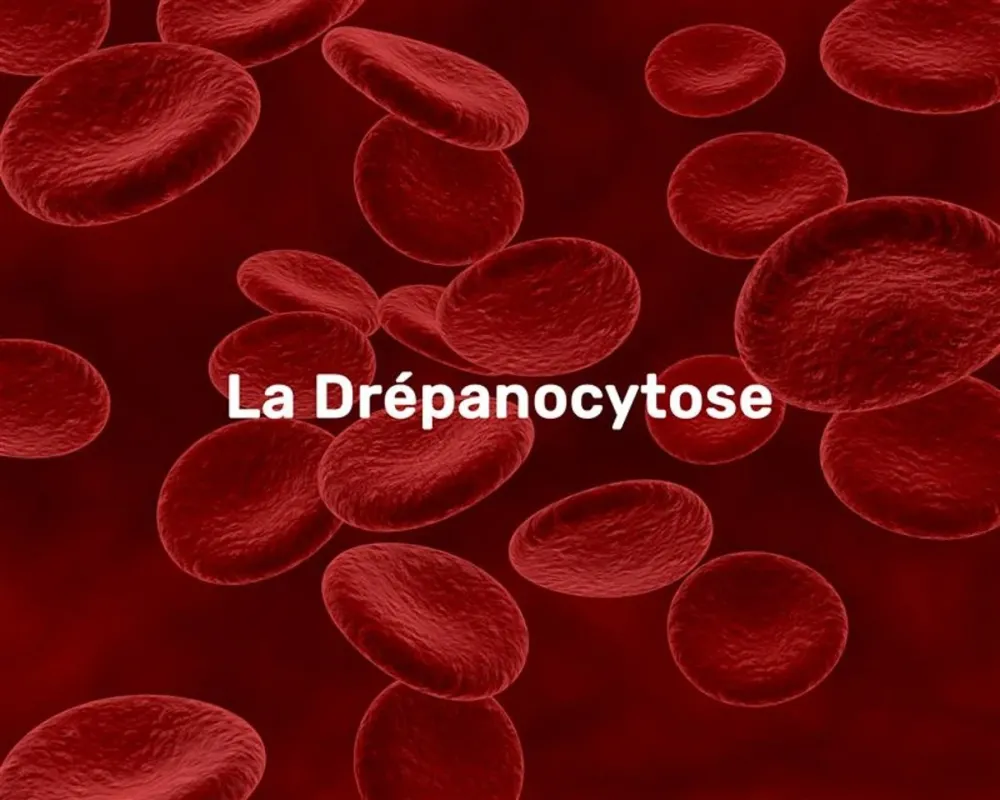 Drépanocytose au Bénin : « Une urgence de santé publique encore sous-estimée », alerte le Dr Gnanvi Ayodélé Douceline